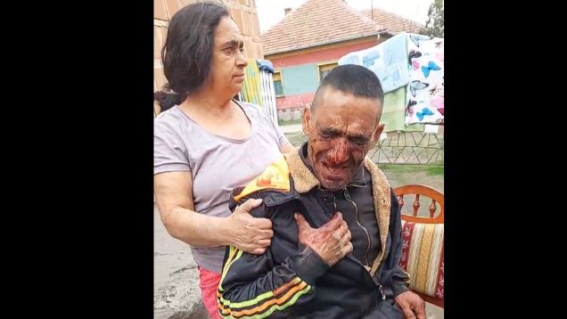 Brutálisan megkínoztak egy cigány férfit Jászkarajenőn